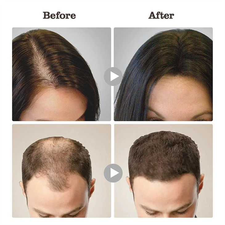 Hair Growth Rice Handmade Soap